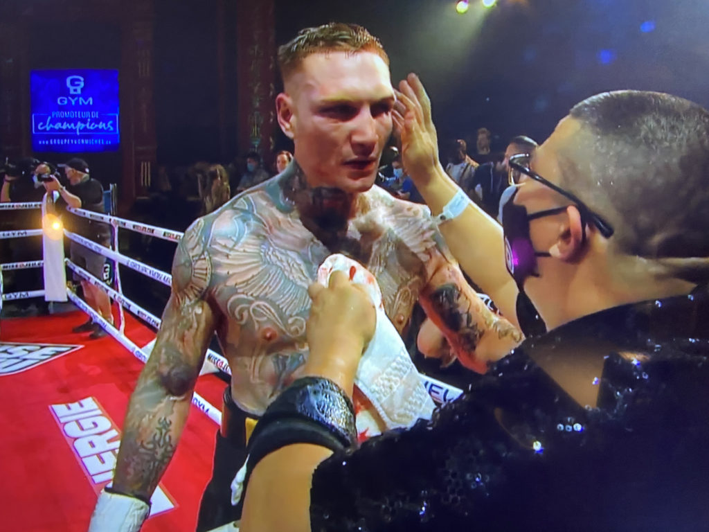 Ryan Rozicki receives treatment from his cut man during his fight with Oscar Rivas in Montreal.